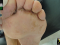 1_Bromhidrose-12092026-Copier-Copier-Copier