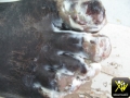 Gangrene.