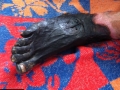 gangrene-gazeuse-1