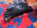 gangrene-gazeuse-2