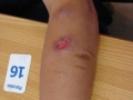 Pyodermites, automutilation, drogues.