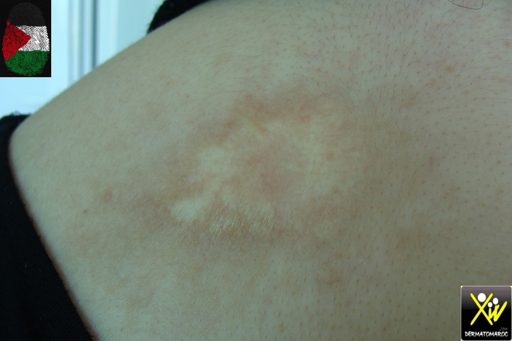 morphee