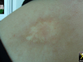 morphee