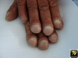 Hippocratisme digital