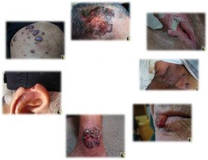 Dermatomaroc 6th update 10.